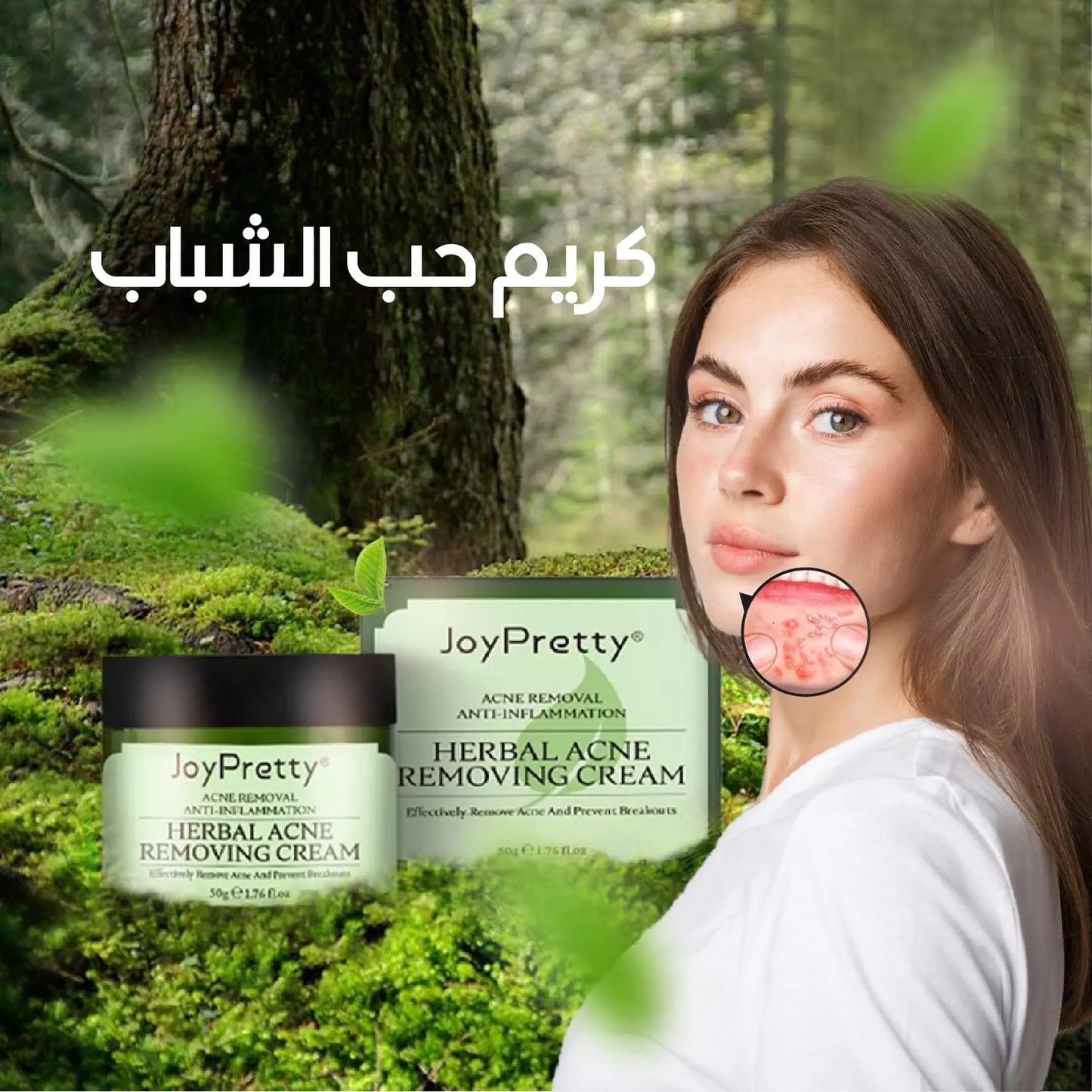 Acne Protection Cream